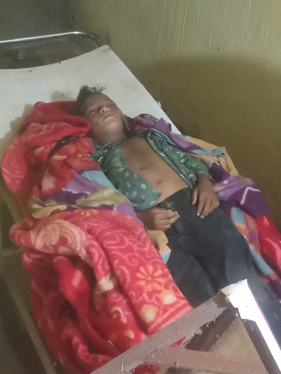 पेड़ के नीचे बैठना पड़ा भारी : आकाशीय बिजली की चपेट में आए 4 बच्चे, 2 की मौके पर मौत